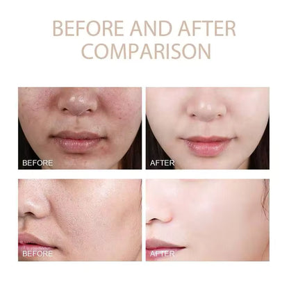 [Dr.Melaxin Official] Peel Shot Glow Rice Ampoule Duo - Serums for Brightening, Exfoliating, and Moisturizing - Suitable for All Skin Types